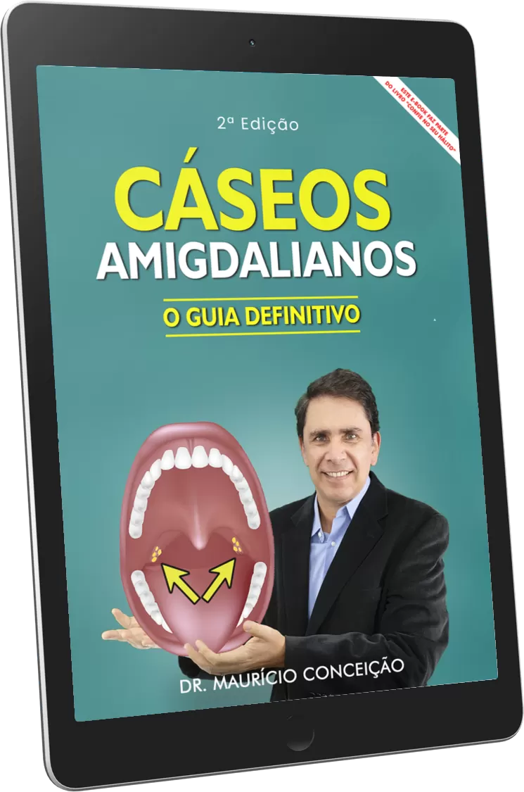 E-book Halitus — Cáseos Amigdalianos, o guia definitivo